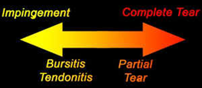 Tendonitis