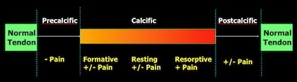 Calcific tendinitise Phases