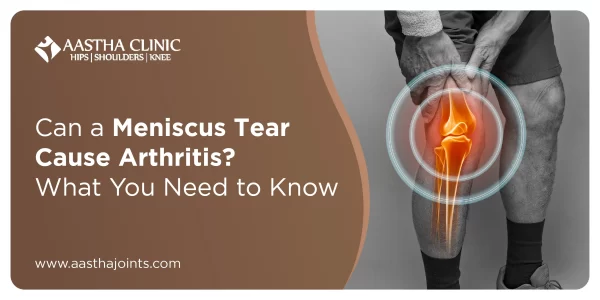 Can a Meniscus Tear Cause Arthritis? What You Need to Know