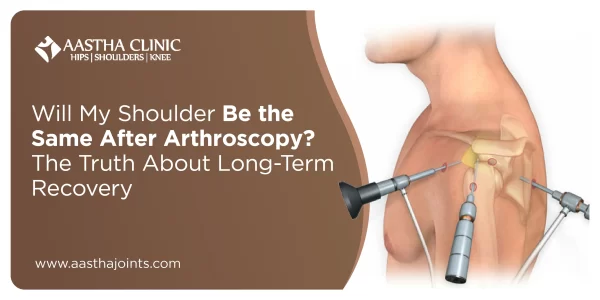 Will My Shoulder Be the Same After Arthroscopy? The Truth About Long-Term Recovery