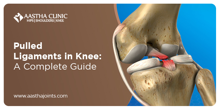 Medical illustration of knee ligaments showing injury, used as a banner for the blog “Pulled Ligaments in Knee: A Complete Guide” by Aastha Joints Clinic.