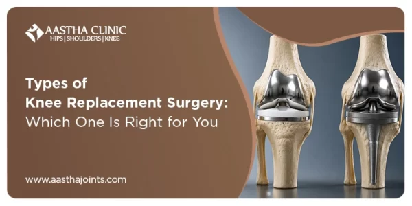 Two knee replacement implant models showing metal and plastic components, Aastha Clinic Surat, by Dr. Krunal Shah