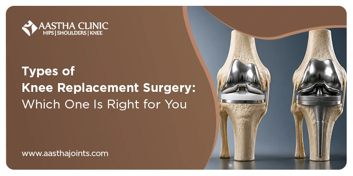 Two knee replacement implant models showing metal and plastic components, Aastha Clinic Surat, by Dr. Krunal Shah